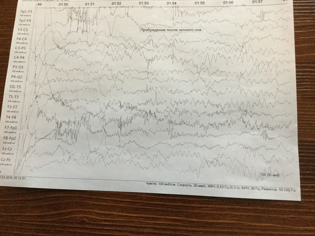 1F29BB83-457E-437B-BE5D-285BE65A6546