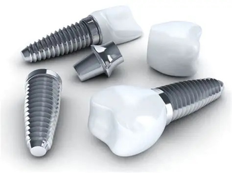 Which Types of Dental Implants Might a Dentist Recommend for Missing Teeth?