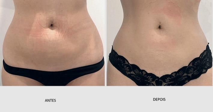 Projeto 14
