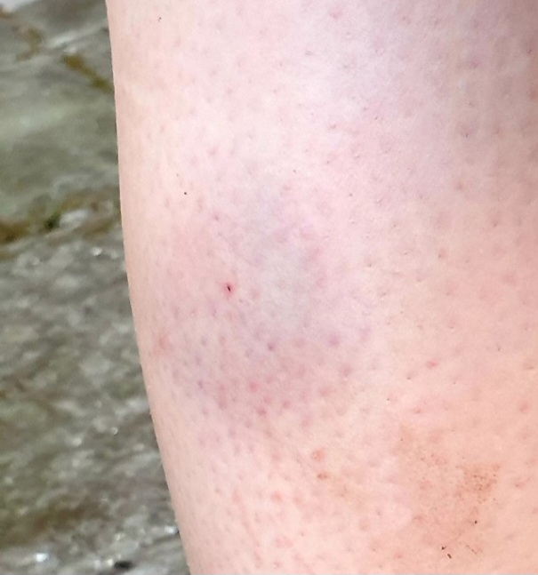 Screenshot_20250928_095217_Photos