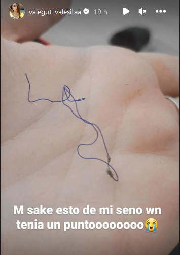 gut.png