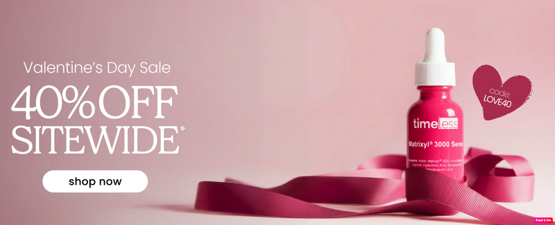 vartotojo �kelta nuotrauka