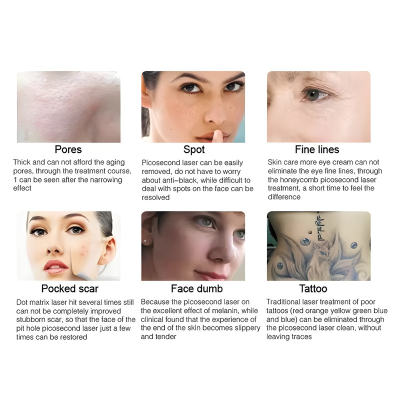 Description of the image