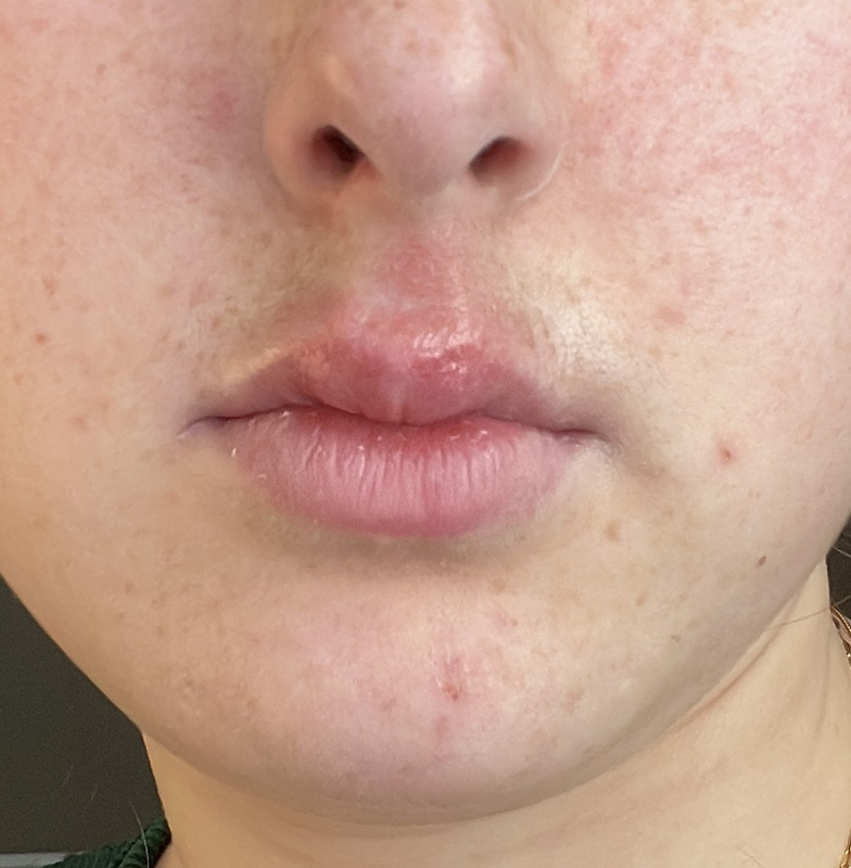 207CE91A-75F6-45C0-8F5E-2FCA9FA63BBE