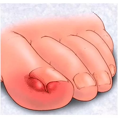 2A29725C-A7F8-415F-89F1-6CAD1DD4C6B0