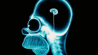 homer-brain-scan.jpg