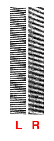 LvsR