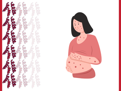 Sífilis: a grande enganadora continua enganando