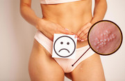 Ilustração dos sintomas e fases de ativação do vírus da herpes genital e labial