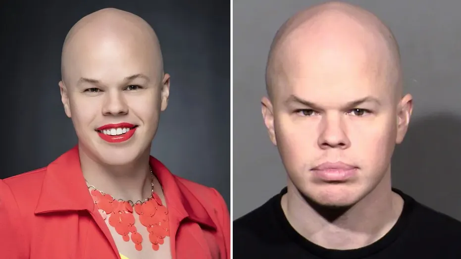Brinton-before-after