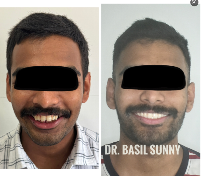 Clinical Case Record 1