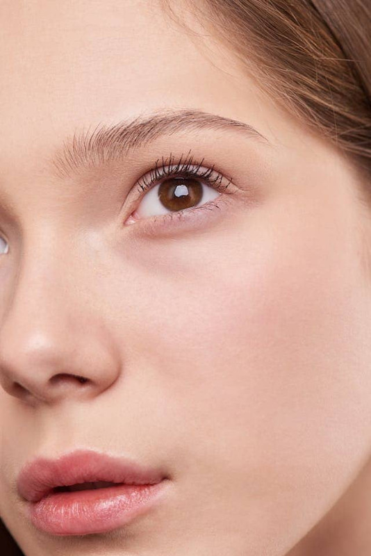 a woman with dry skin and skin barrier damage that leads to dull, dehydrated skin 