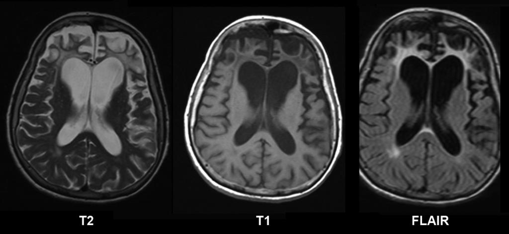 Neurology question 8 image