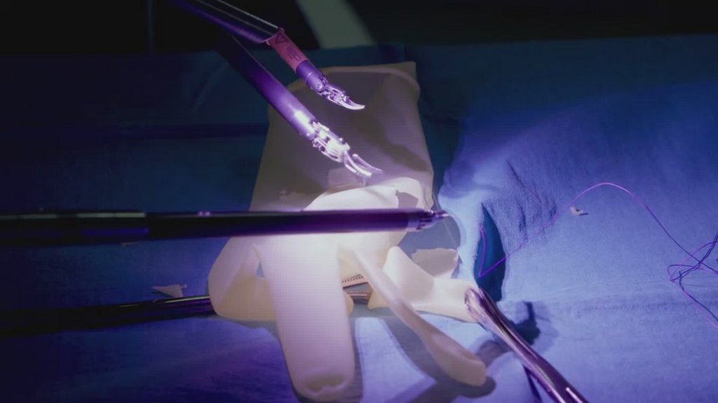 [Image: 63f6t0snpnai.jpg]