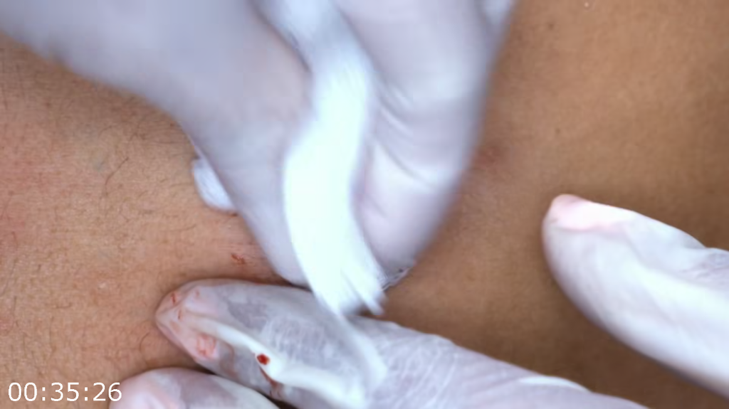 [Image: pjft4ye15x1t.png]