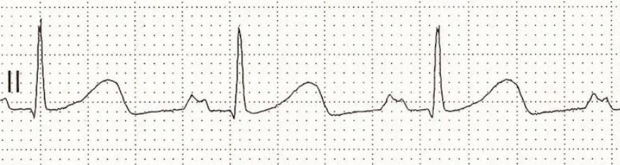 Cardiology question 9 image