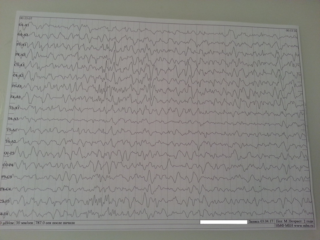 ээг 2 года с.1
