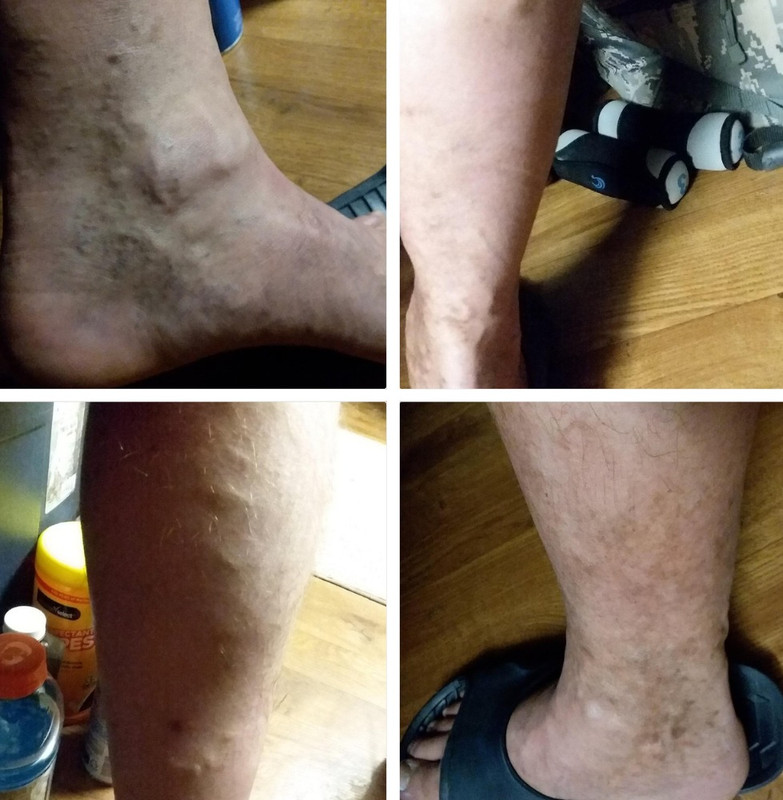 Depoimento VENACIL 3