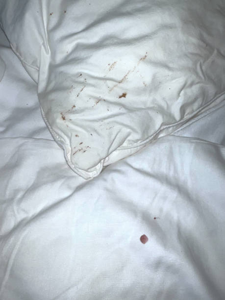 Bed-Bug-Treatment-Kissimmee-7.jpg