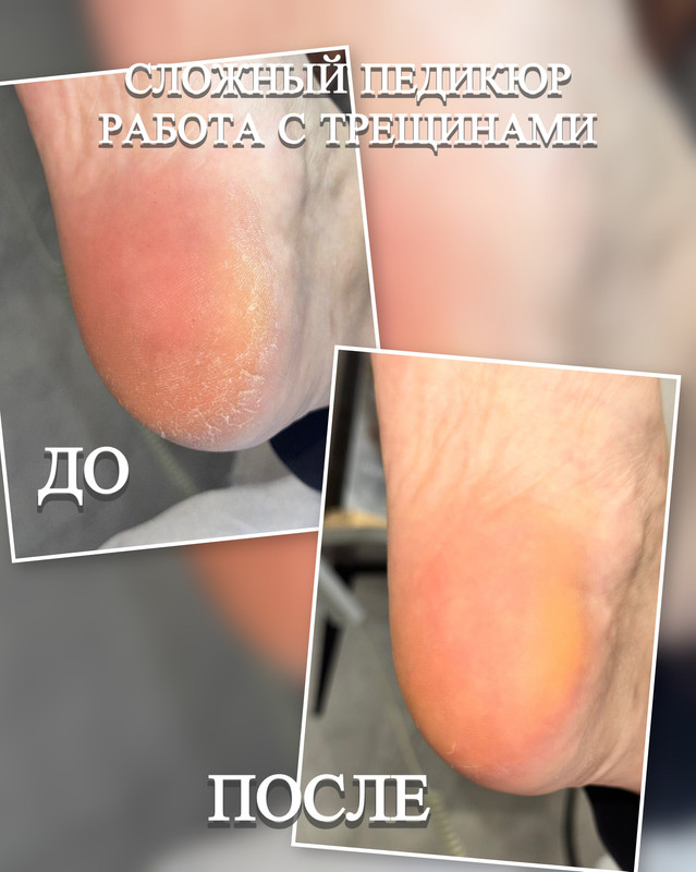 подология новая 2