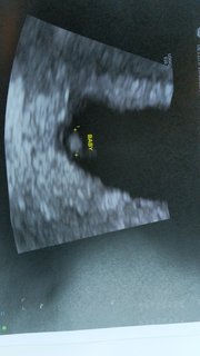 IMG-20201118-WA0000