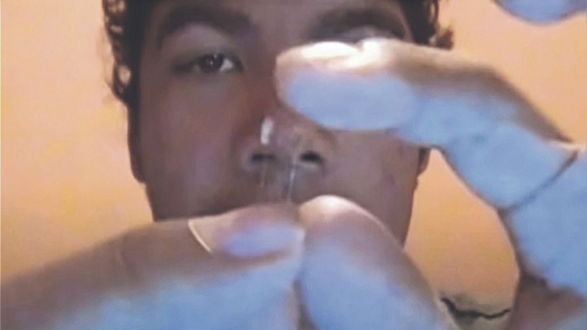 Intenta operarse la nariz con tutorial de YouTube y termina en urgencias