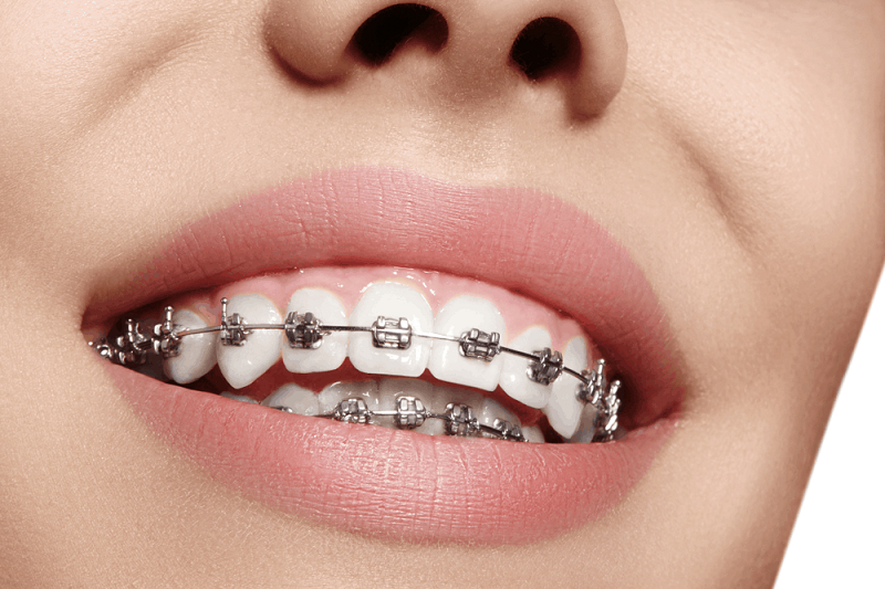 Orthodontics 