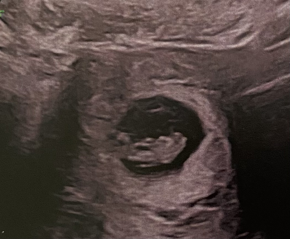 60515BC7-D3D6-455E-BFD9-D2F0B4953588