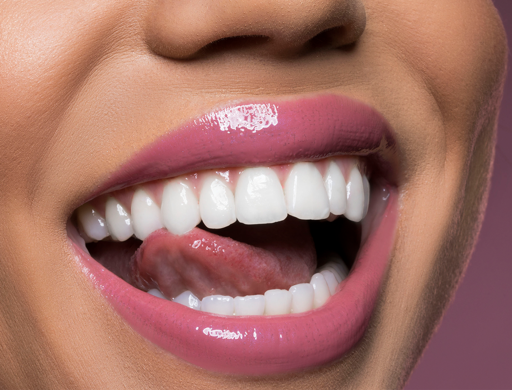 Отбеливание зубов: мифы, реальность и современные решения