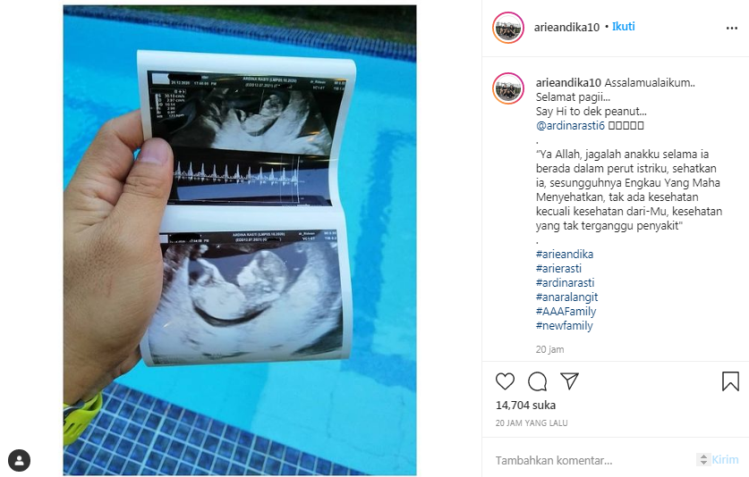 Arie Dwi Andika umumkan Ardina Rasti hamil anak kedua