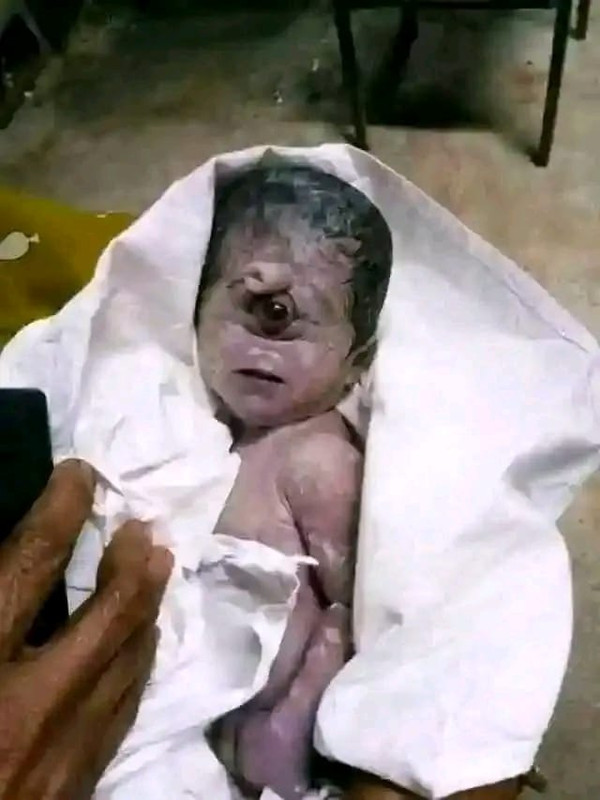 Chad medical case