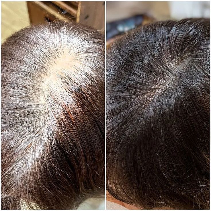 Cambio NovaHair 1