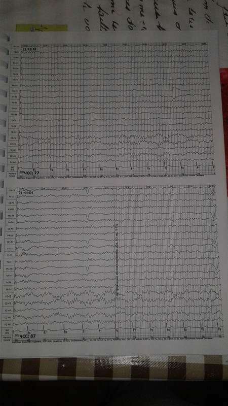 1510522346513-274681655