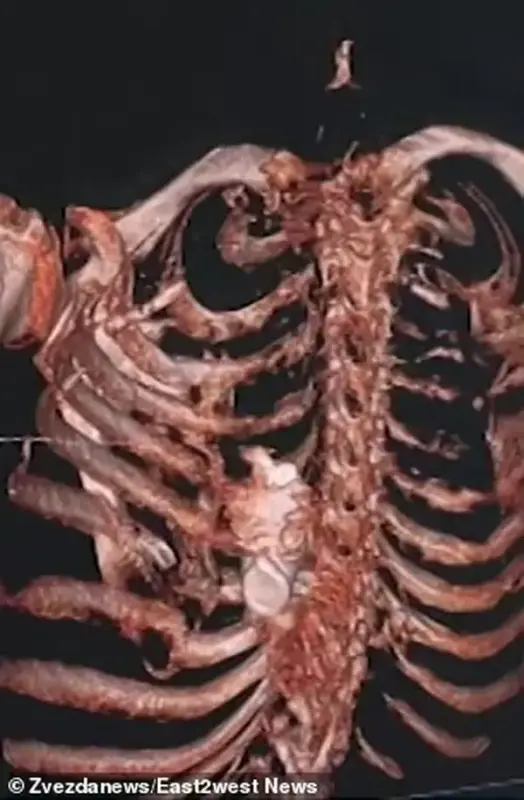 W47WBZFOIND4LILZI32LZC2S64