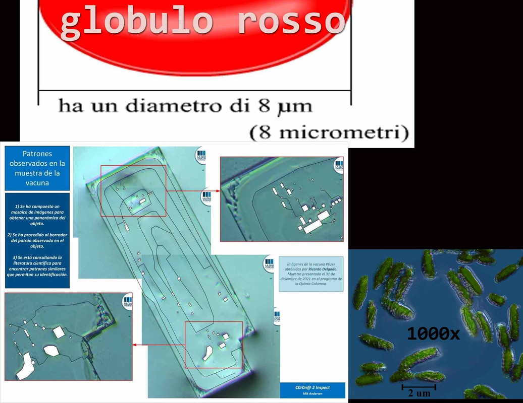 resized-micro-nel-v