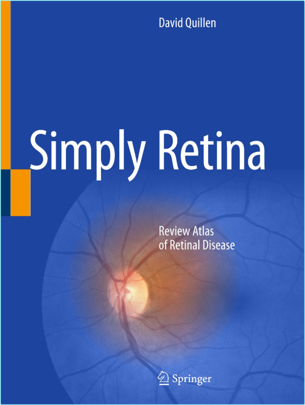 Quillen D Simply Retina Review Atlas Of Retinal Disease 2025