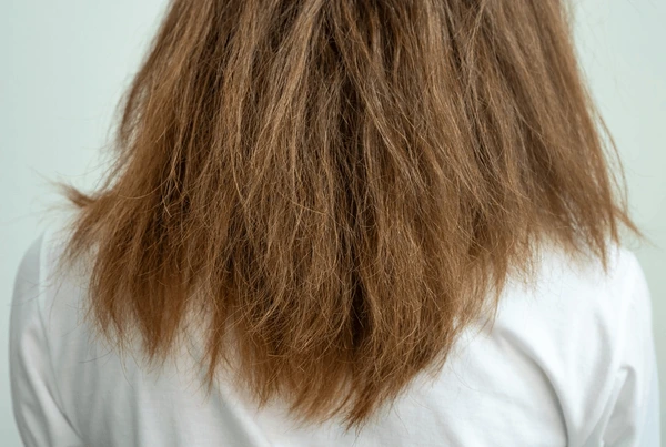 Tratamento por fora não basta