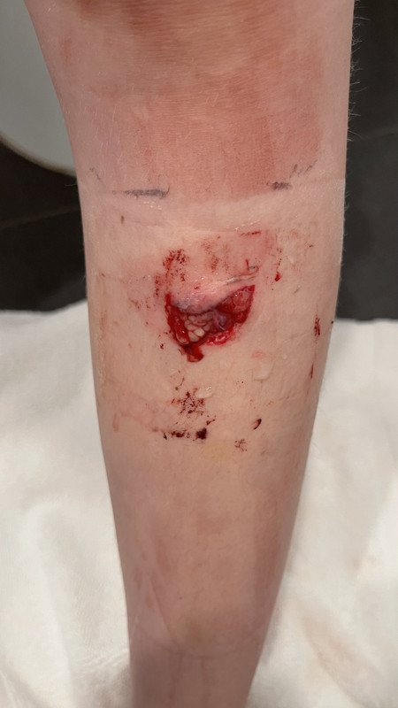 C932510C-0F0B-4A3F-B14F-27B04711BA51