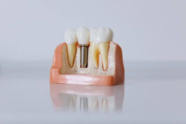 Cosmetic Dentistry Trends in Mumbai
