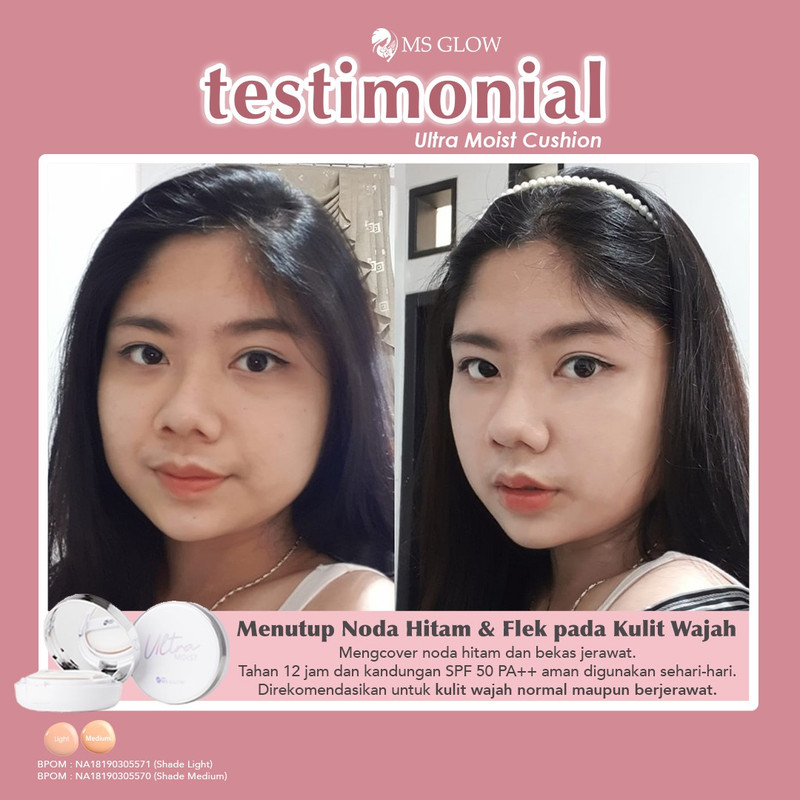 testimoni ms glow skin care