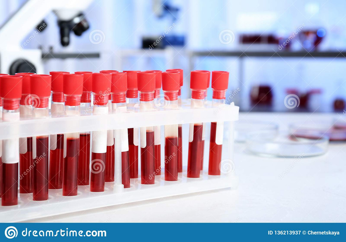 пробирки-с-пробами-крови-для-анализа-на-таблице-в-лаборатории-136213937
