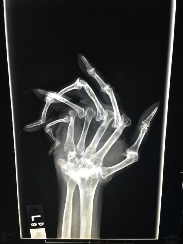 Rayos-X-23