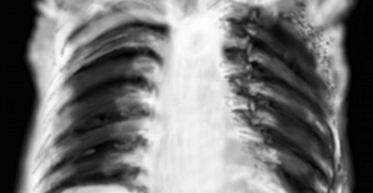 ECE4684B-9619-4C45-BE00-8469FCA21736