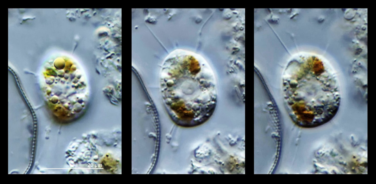 03 Sauginfusorium (ub) oder Heliozoon Feuchtwiese Freudenberg DIK 100 Komp 3