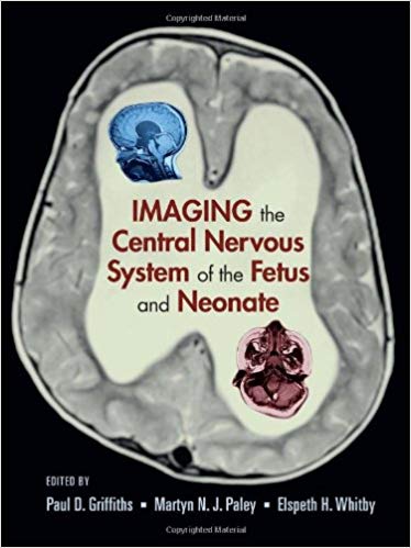 Imaging the Central (Nervous System) of the Fetus and Neonate Imaging the Central (Nervous System) of the Fetus and Neonate