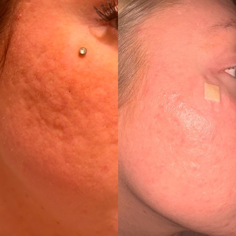 Depoimento de cliente — Retinol Dermabem