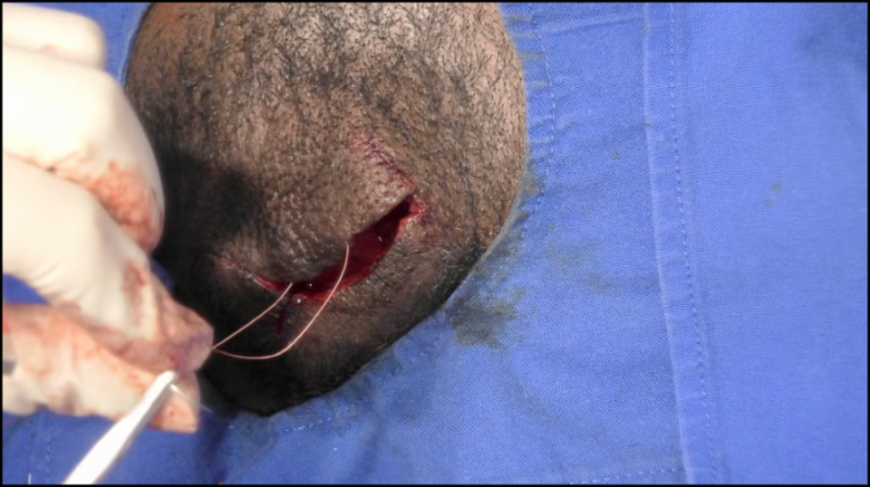 [Image: y1dhl42ho1bb.png]