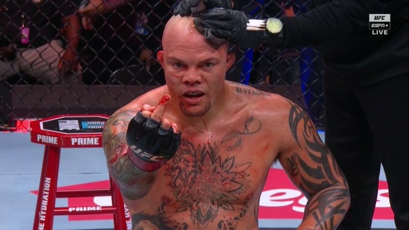 Дилън Данис: Антъни Смит има сърцето на пудел