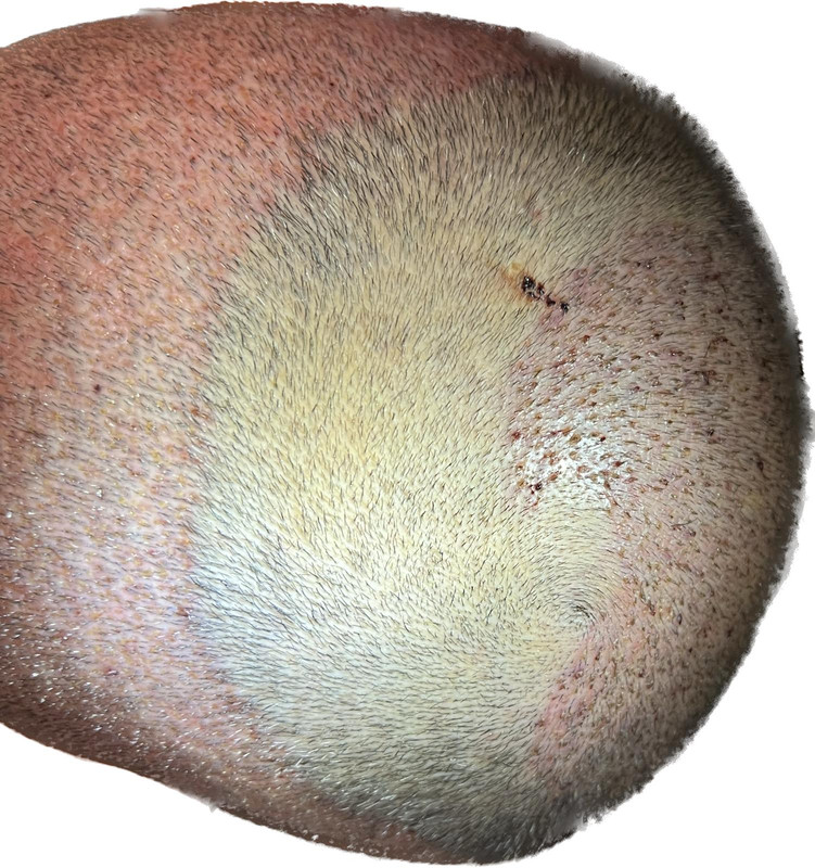 15CE8289-DFE5-4B2B-8CC5-24447CC7D84B
