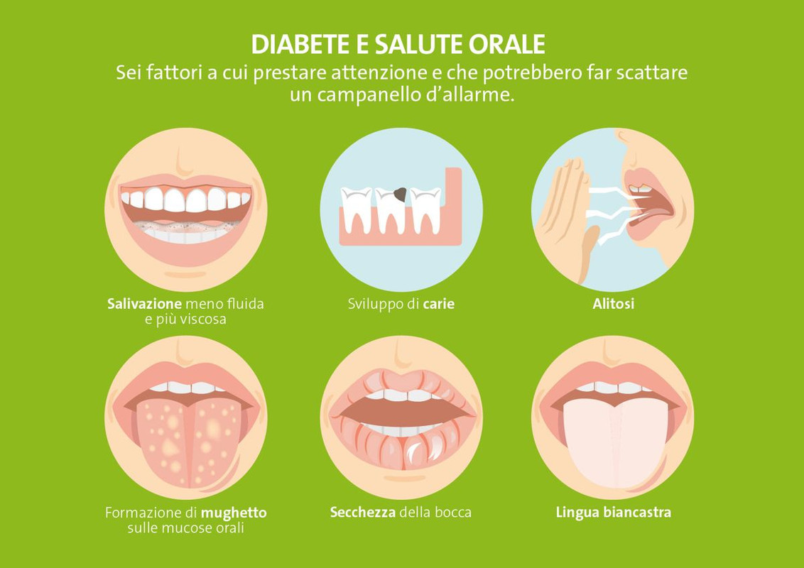 Diabete e salute orale segnali di allarme Infografica Straumann Group